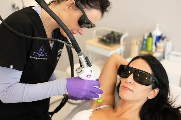 laser hair removal