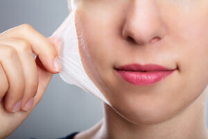 Close-up of a woman pulling a face mask off of her skin, like remove flakey skin after a chemical peel.