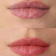 Collage with photos of young woman before and after permanent lip makeup, closeup